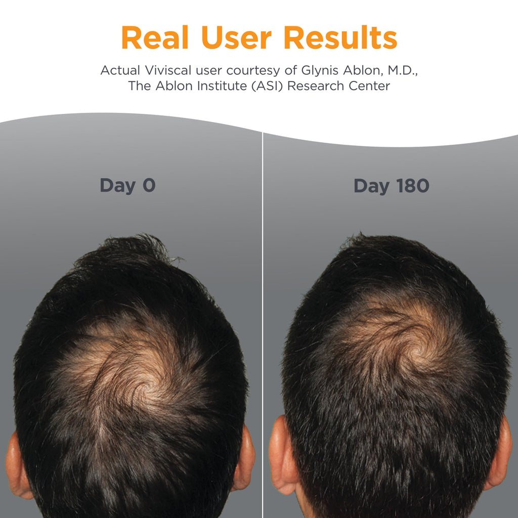 Men's Hair Growth Supplements 180 Tablets S7833