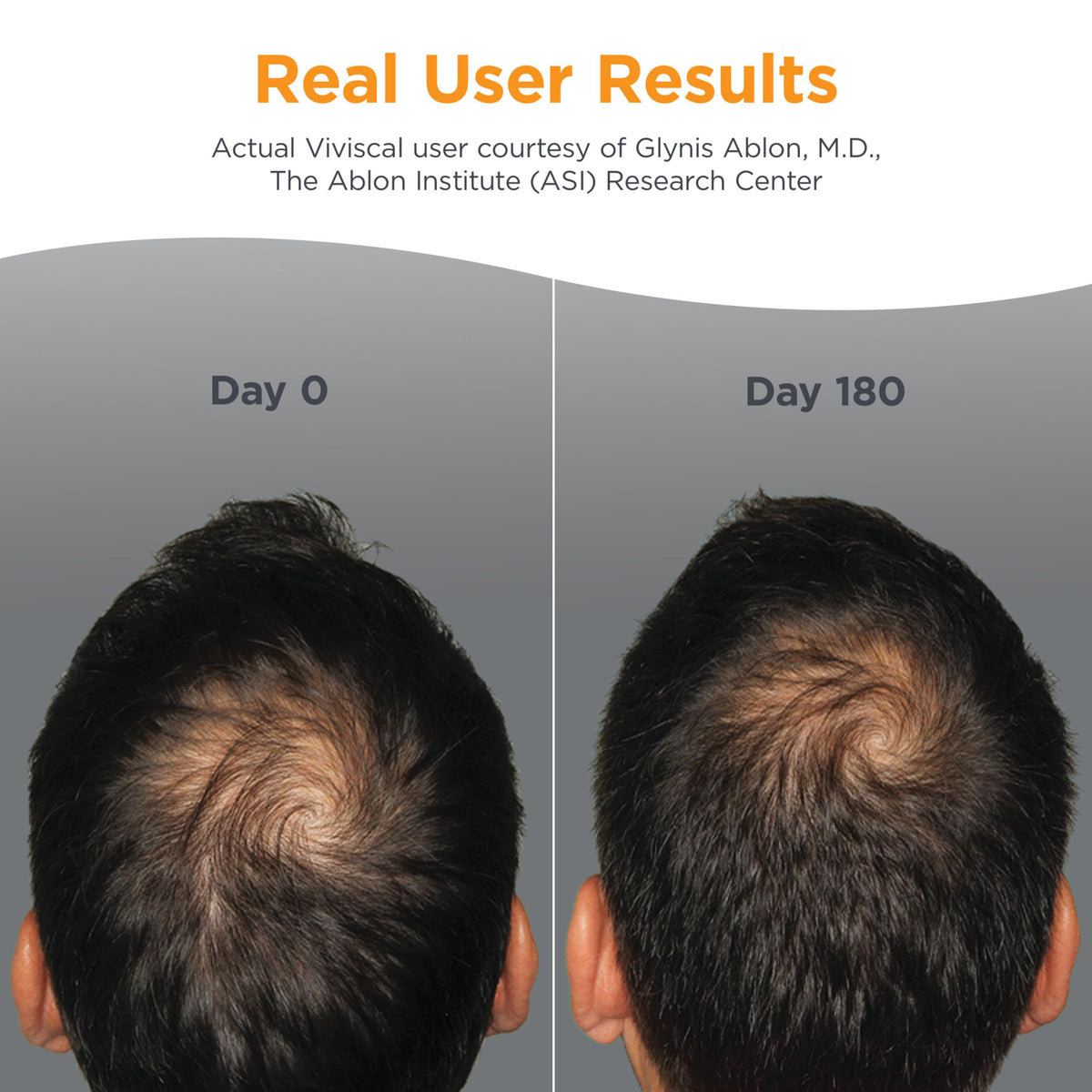 Men's Hair Growth Supplements 180 Tablets S7833